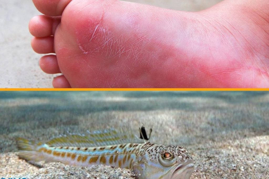 pez arana pequeno que es un pez arana fotos del pez arana y picadura pez arana imagenes